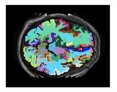 AI e ricerca biomedica