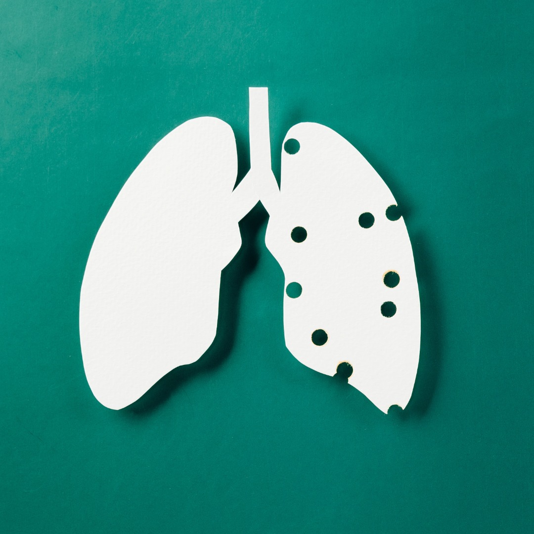 Giornata della Tubercolosi: l’impegno della sanità modenese su prevenzione e trattamento