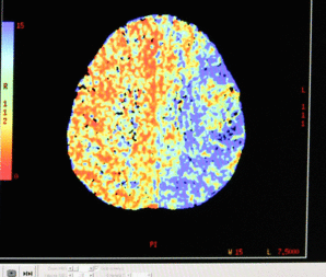 Esempio di immagini angiografica